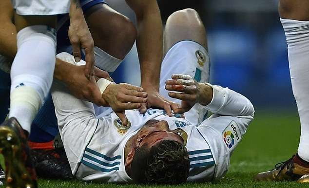 «Послематчевое селфи испорчено!»: Криштиану Роналду разбили лицо во время игры