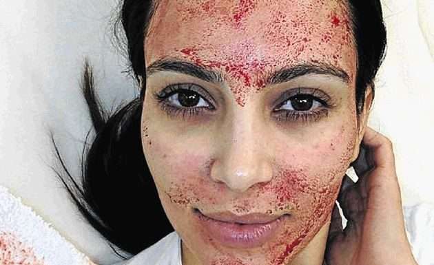 7 найдивніших процедур для обличчя