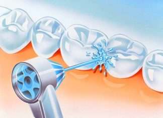 Сучасний догляд за зубами: іригатори