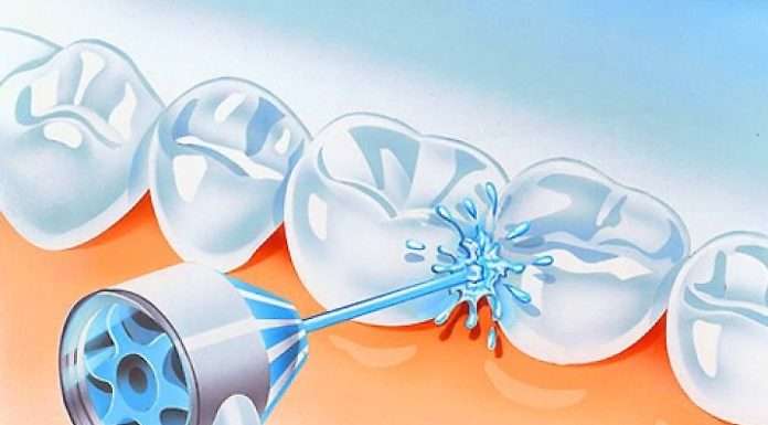 Сучасний догляд за зубами: іригатори