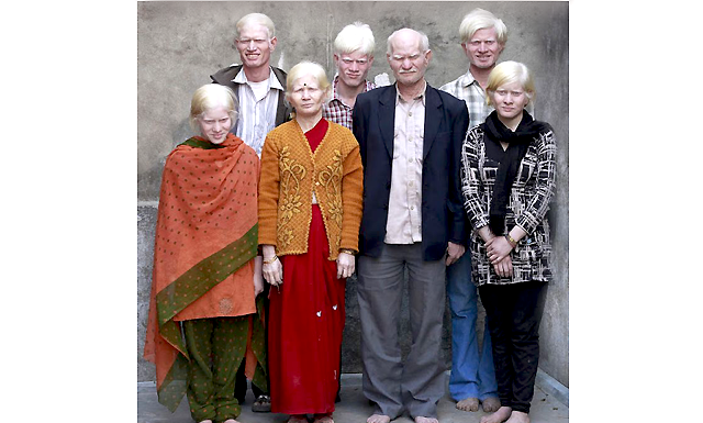 Найбільша родина альбіносів.