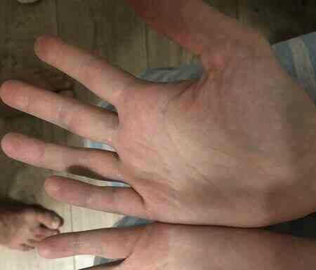 Щось з пальцями стало …