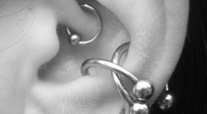 Чи Може Пірсинг Ясен Або Козелка Допомогти При Мігрені? Лікарі Пояснюють