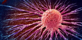 Global Cancer Surge: World Faces Escalating Crisis