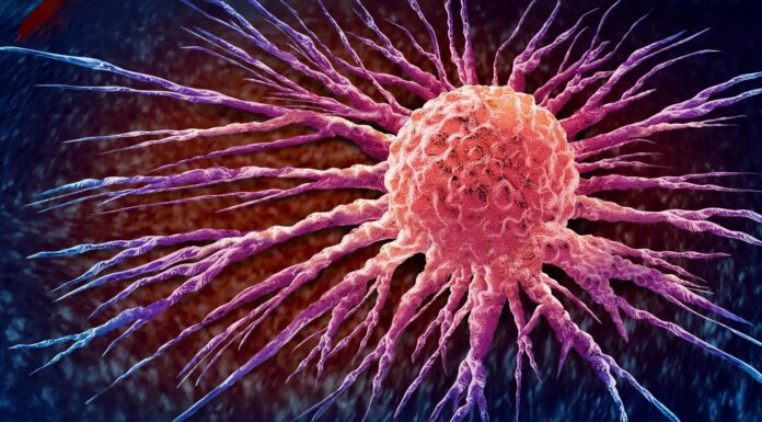 Глобальне зростання раку: світ стоїть перед ескалацією кризи