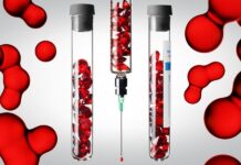 PRP-терапия: что врачи хотят, чтобы пациенты знали