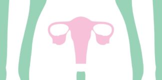 «Тихий убийца»: как распознать едва уловимые признаки рака яичников