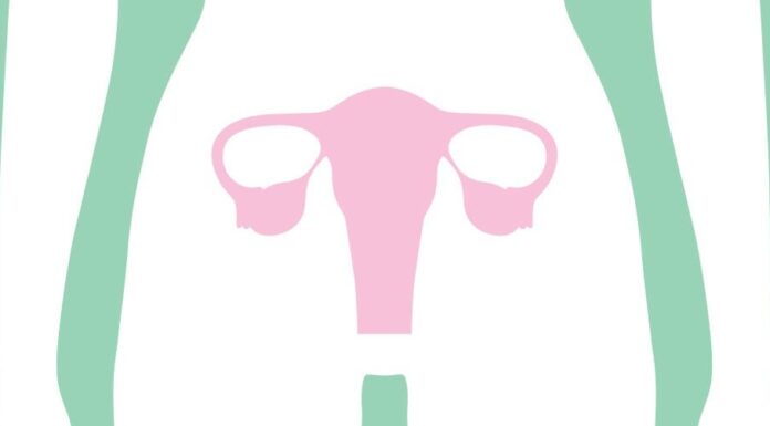 «Тихий убийца»: как распознать едва уловимые признаки рака яичников